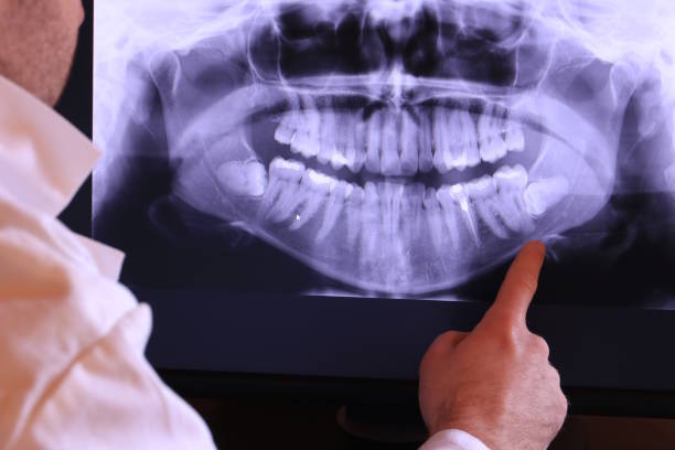 Best Weekend Emergency Dentist in Pleasantdale, NJ