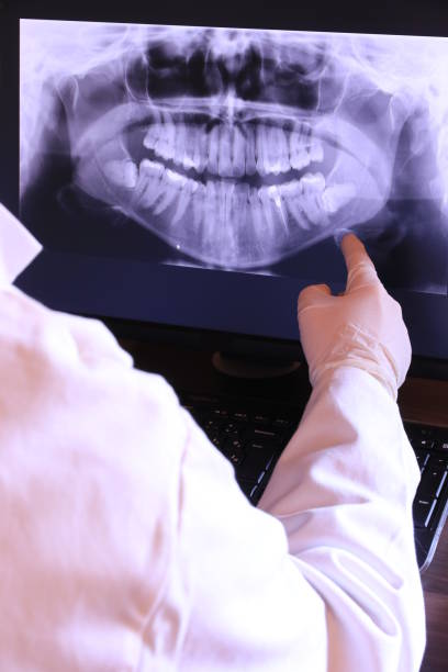 Best Urgent Care for Lost Fillings or Crowns in Pleasantdale, NJ