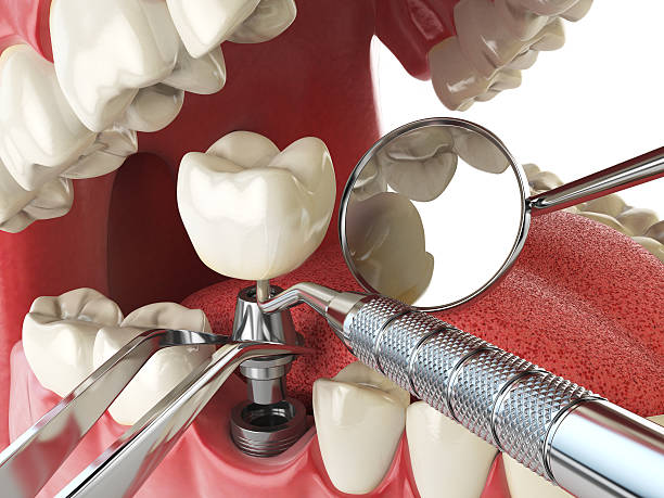 Best Emergency Denture Repair in Pleasantdale, NJ